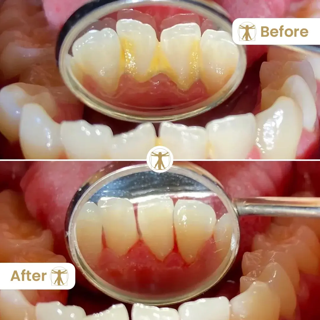 Hygiene Before and After